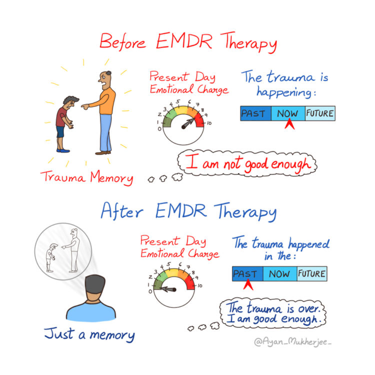 This Graphic Perfectly Shows How EMDR Can Help You With Trauma | Source: https://themighty.com/topic/trauma/therapy-illustrated-emdr-graphic-trauma/